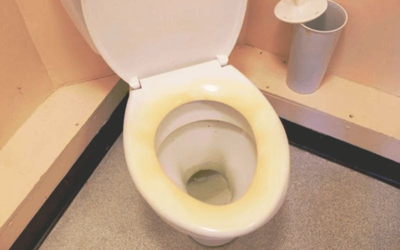 nap-nhua-bon-cau-bi-o-vang-do-nhieu-nguyen-nhan Bồn cầu có vết ố vàng, cần được vệ sinh. Nội thất phòng tắm với bề mặt bẩn, cần chăm sóc định kỳ.